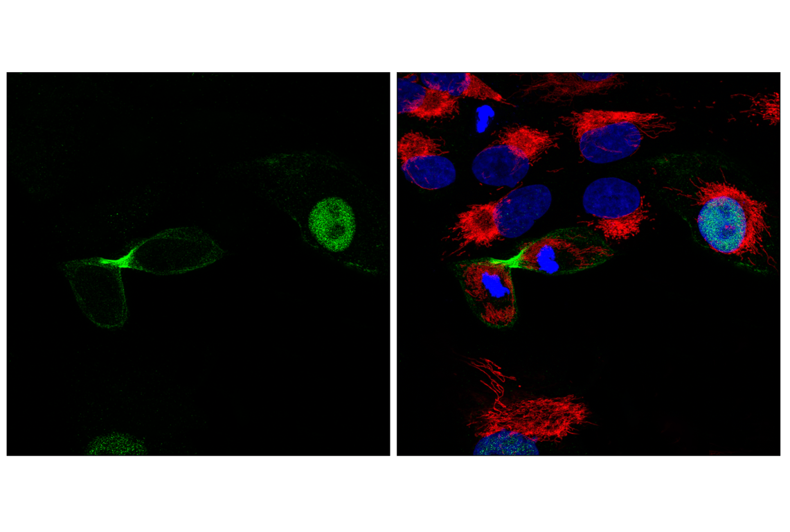 Immunofluorescence Image 2: Anillin (F6M2V) Rabbit Monoclonal Antibody