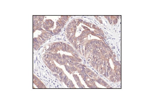 Immunohistochemistry Image 2: NQO1 (A180) Mouse Monoclonal Antibody