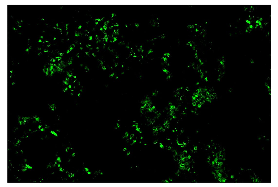 Immunohistochemistry Image 2: CD68 (D4B9C) & CO-0007-750 SignalStar<sup>™</sup> Oligo-Antibody Pair