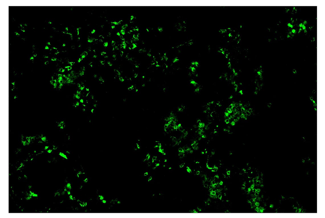 Immunohistochemistry Image 2: CD68 (D4B9C) & CO-0007-647 SignalStar<sup>™</sup> Oligo-Antibody Pair