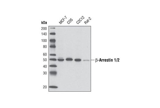 Western Blotting Image 1: β-Arrestin 1/2 (D24H9) Rabbit mAb