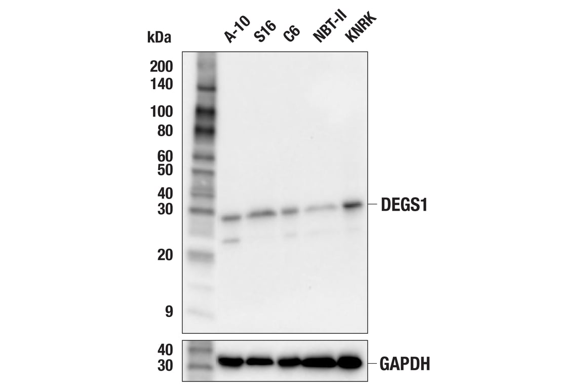 Western Blotting Image 3: DEGS1 (F7G2J) Rabbit Monoclonal Antibody