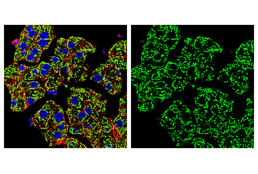 Immunofluorescence Image 3: MAVS (E8Z7M) Rabbit Monoclonal Antibody (BSA and Azide Free)