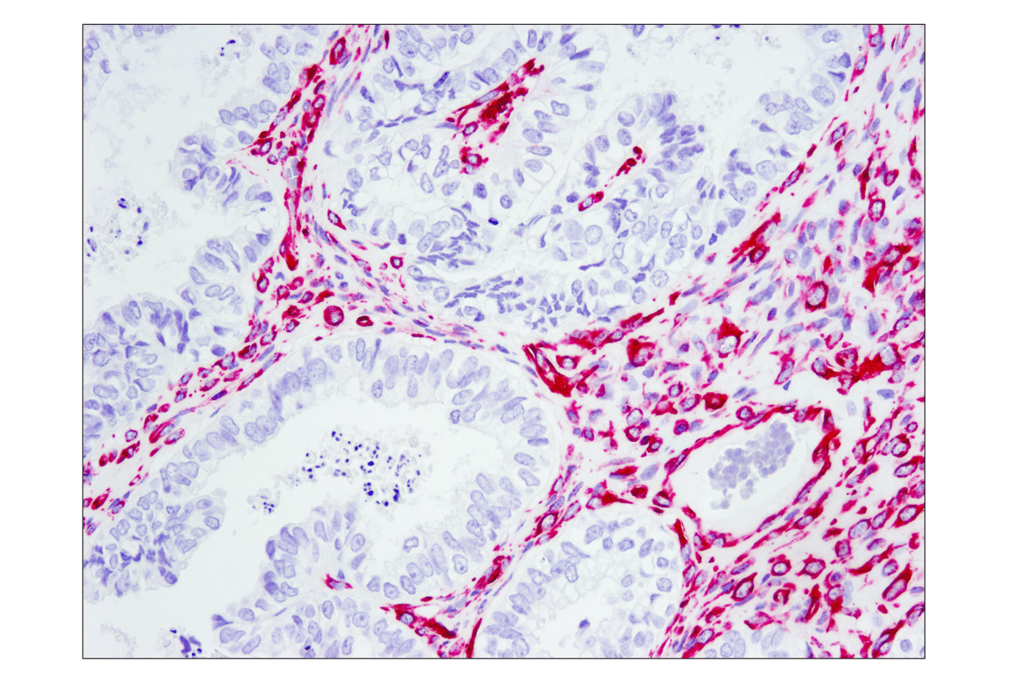 Immunohistochemistry Image 2: SignalStain<sup>®</sup> Boost IHC Detection Reagent (AP, Rabbit)
