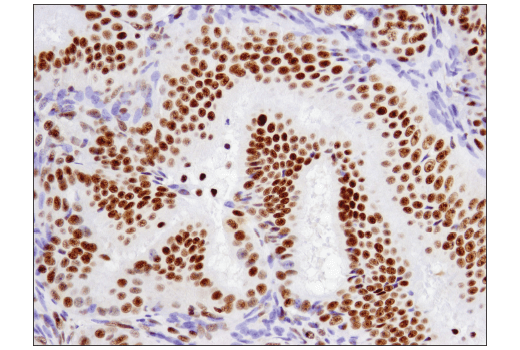 Immunohistochemistry Image 3: ATF-2 (D4L2X) Rabbit Monoclonal Antibody (BSA and Azide Free)