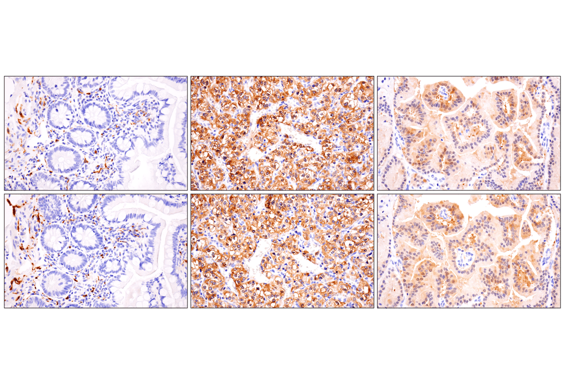 Immunohistochemistry Image 3: Phospho-Tau (Ser202) (F2A2F) Rabbit Monoclonal Antibody