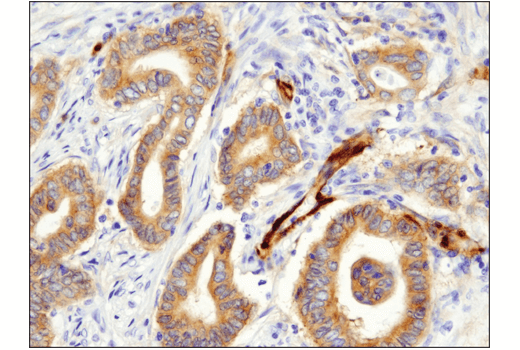 Immunohistochemistry Image 1: FAK (D5O7U) Rabbit Monoclonal Antibody