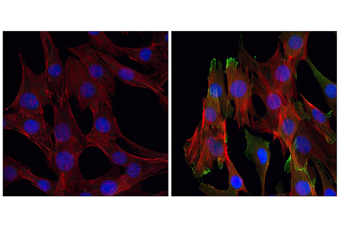 Immunofluorescence Image 1: Phospho-Akt (Ser473) (D9E) Rabbit Monoclonal Antibody