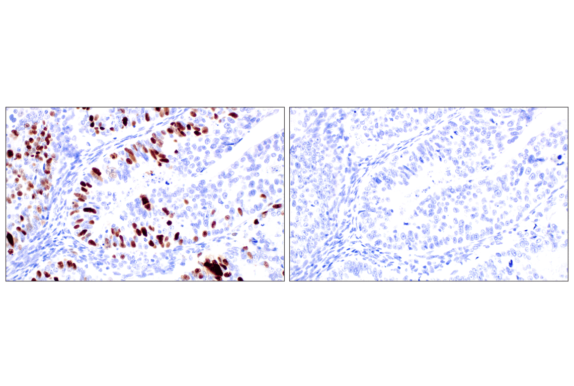 Immunohistochemistry Image 16: Phospho-NPM1 (Thr199) (E4C7S) Rabbit Monoclonal Antibody (BSA and Azide Free)