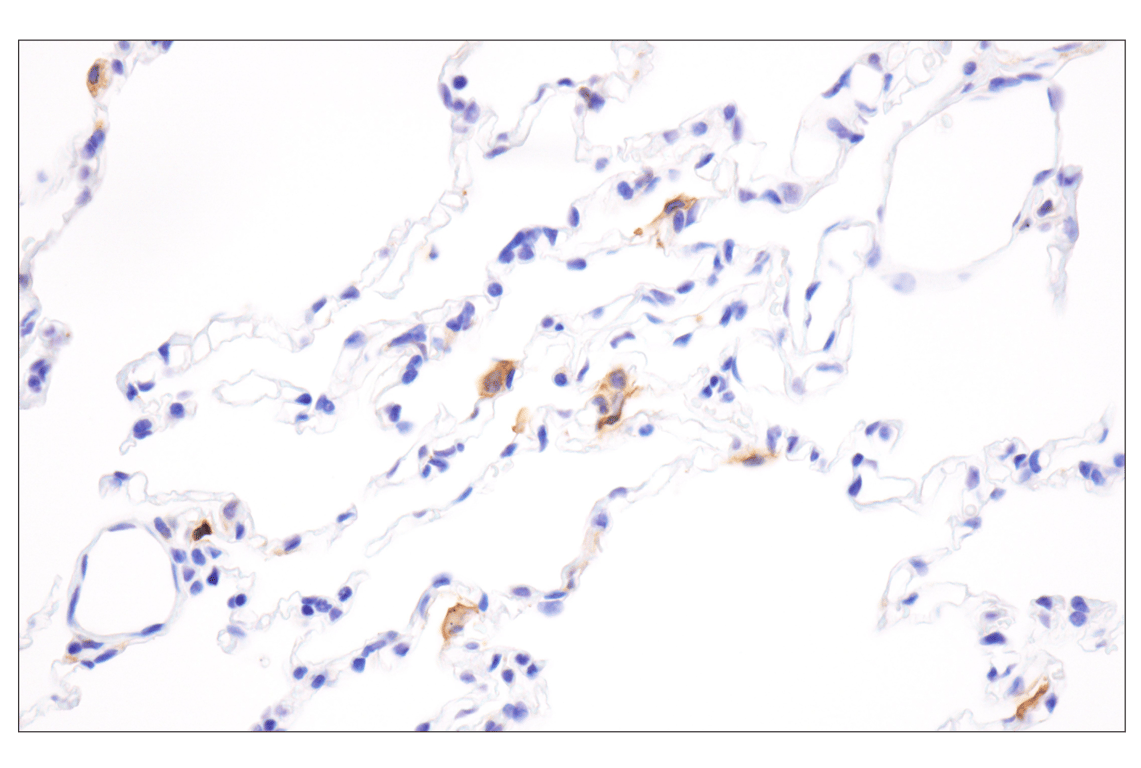 Immunohistochemistry Image 9: HLA-DRA (E9R2Q) Rabbit Monoclonal Antibody (BSA and Azide Free)