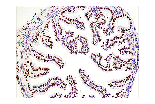 Immunohistochemistry Image 6: Phospho-ATF-2 (Thr71)/ATF-7 (Thr53) (E4A5G) Rabbit Monoclonal Antibody