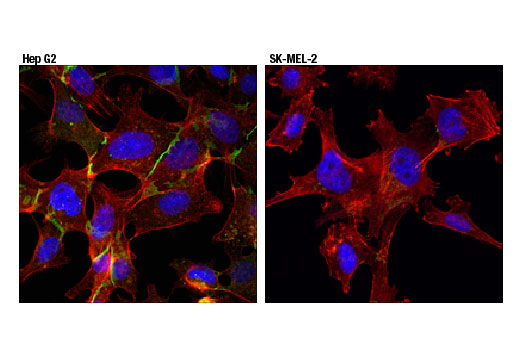 Immunofluorescence Image 1: MRP1/ABCC1 (D7O8N) Rabbit Monoclonal Antibody