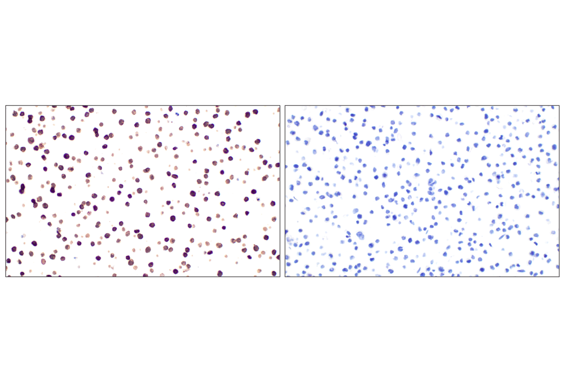 Immunohistochemistry Image 14: CD31 (PECAM-1) (F8M3S) Rabbit Monoclonal Antibody