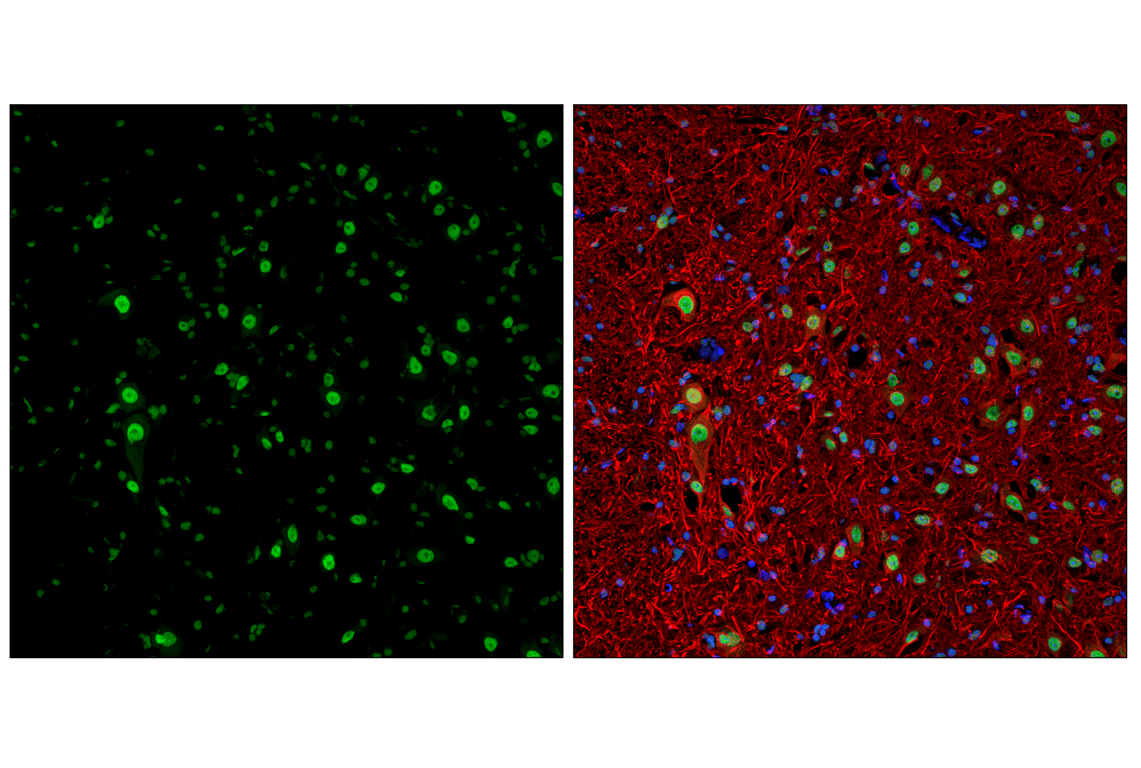 TDP43 (D9R3L) Feline Chimeric Monoclonal Antibody | Cell Signaling
