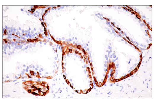 Immunohistochemistry Image 8: Keratin 7 (RN7) Mouse Monoclonal Antibody