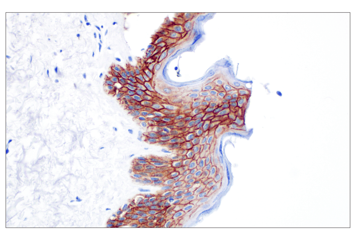 Immunohistochemistry Image 4: CD44 v6 (C44Mab-9) Mouse Monoclonal Antibody