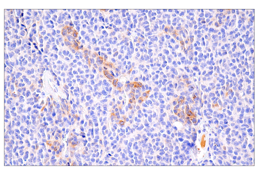 Immunohistochemistry Image 5: PAI-1 (E3I5H) Rabbit Monoclonal Antibody (BSA and Azide Free)