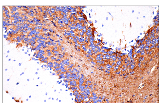 Immunohistochemistry Image 14: CD38 (E9F5A) Rabbit Monoclonal Antibody