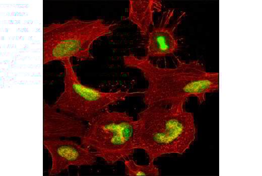 Immunofluorescence Image 1: RCC1 (D15H6) Rabbit Monoclonal Antibody