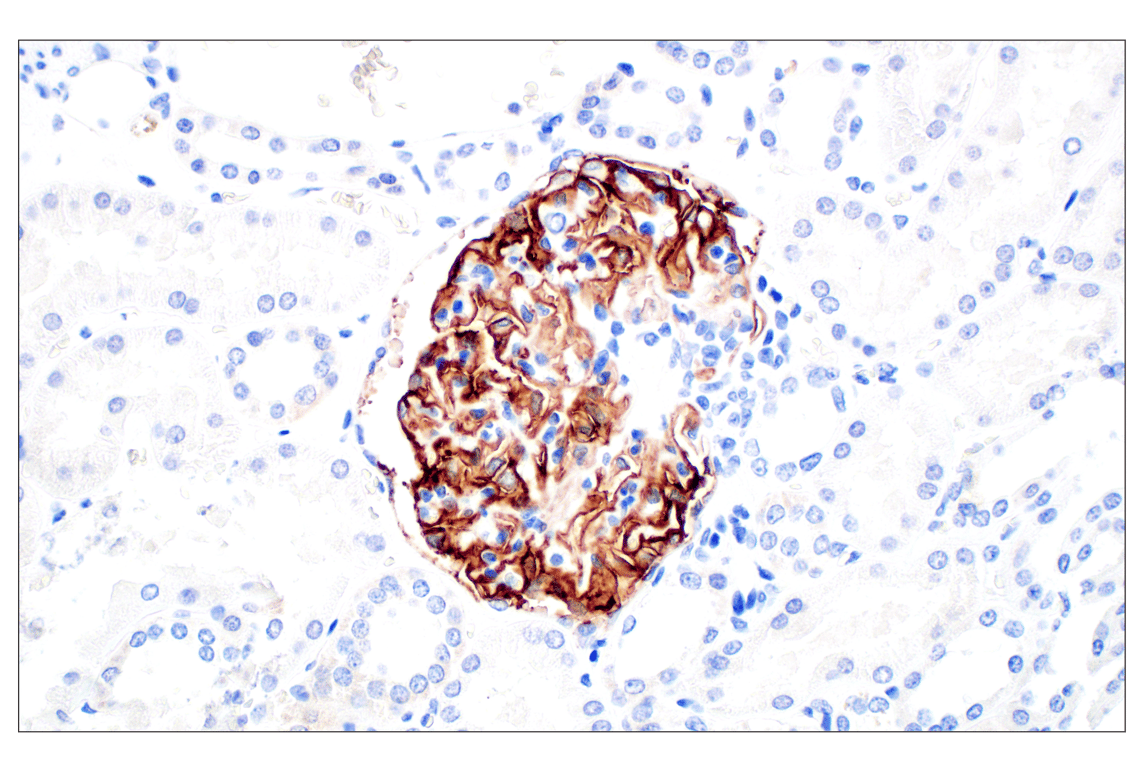 Immunohistochemistry Image 3: CR1/CD35 (E8B1Z) Rabbit Monoclonal Antibody