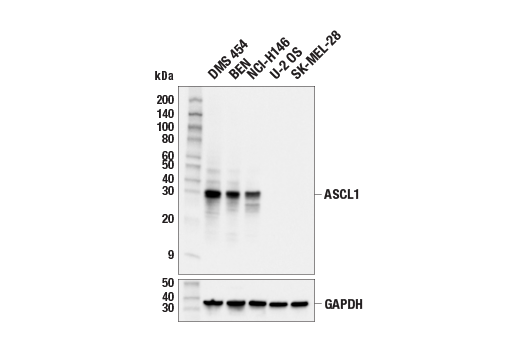 Western Blotting Image 1: ASCL1 (E5S4Q) XP<sup>®</sup> Rabbit mAb