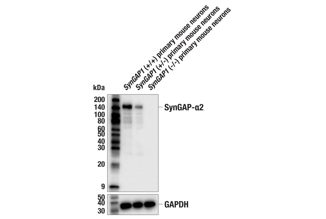 Western Blotting Image 2: SynGAP-alpha2 (E4Y6I) Rabbit Monoclonal Antibody