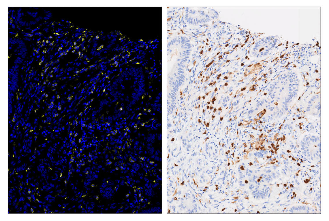 Immunohistochemistry Image 2: S100A9 (D5O6O) & CO-0180-647 SignalStar<sup>®</sup> Oligo-Antibody Pair