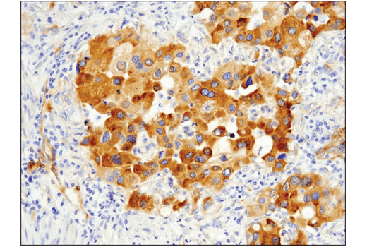 Immunohistochemistry Image 3: FAK (D5O7U) Rabbit Monoclonal Antibody (BSA and Azide Free)