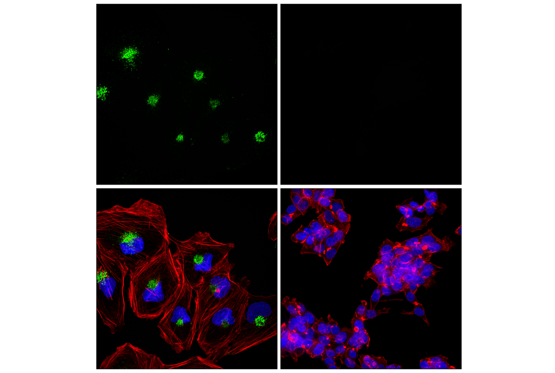 Immunofluorescence Image 2: MCP-1 (F9I9N) Rabbit Monoclonal Antibody