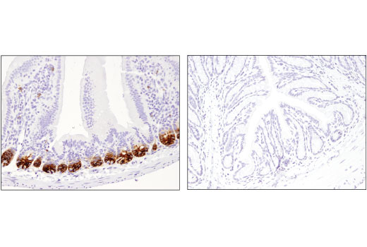 Immunohistochemistry Image 2: Olfm4 (D6Y5A) Rabbit Monoclonal Antibody
