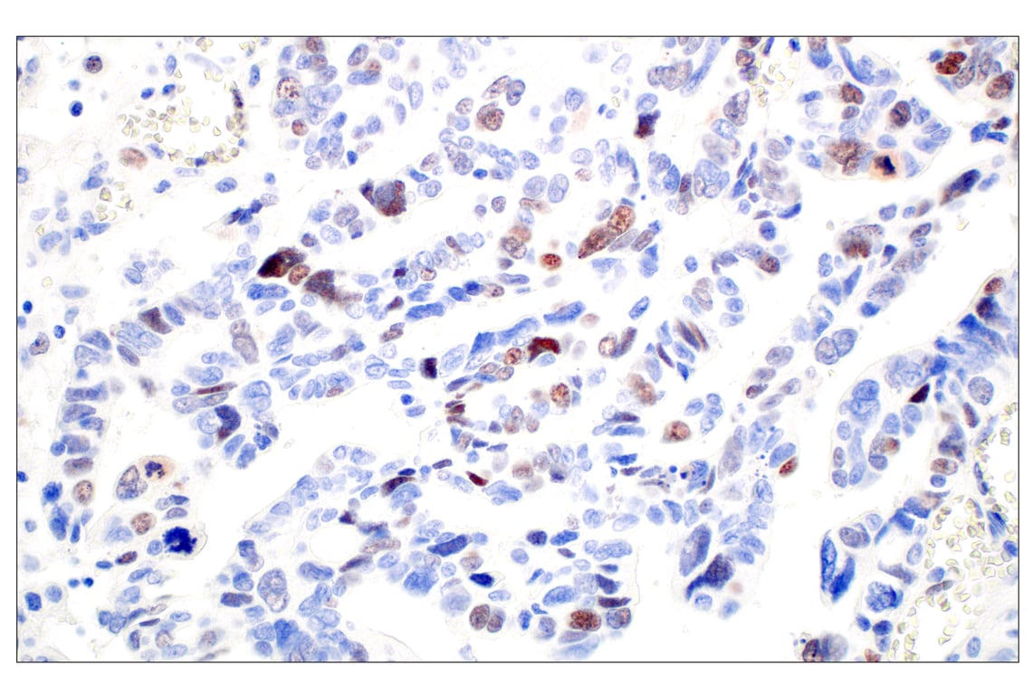 Immunohistochemistry Image 4: SGO2 (E9K4N) Rabbit Monoclonal Antibody