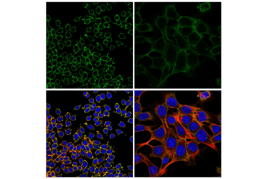 Immunofluorescence Image 1: Crry (E9M7T) Rabbit Monoclonal Antibody