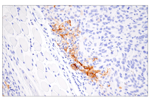 Immunohistochemistry Image 3: iNOS (E1W4J) Rabbit Monoclonal Antibody