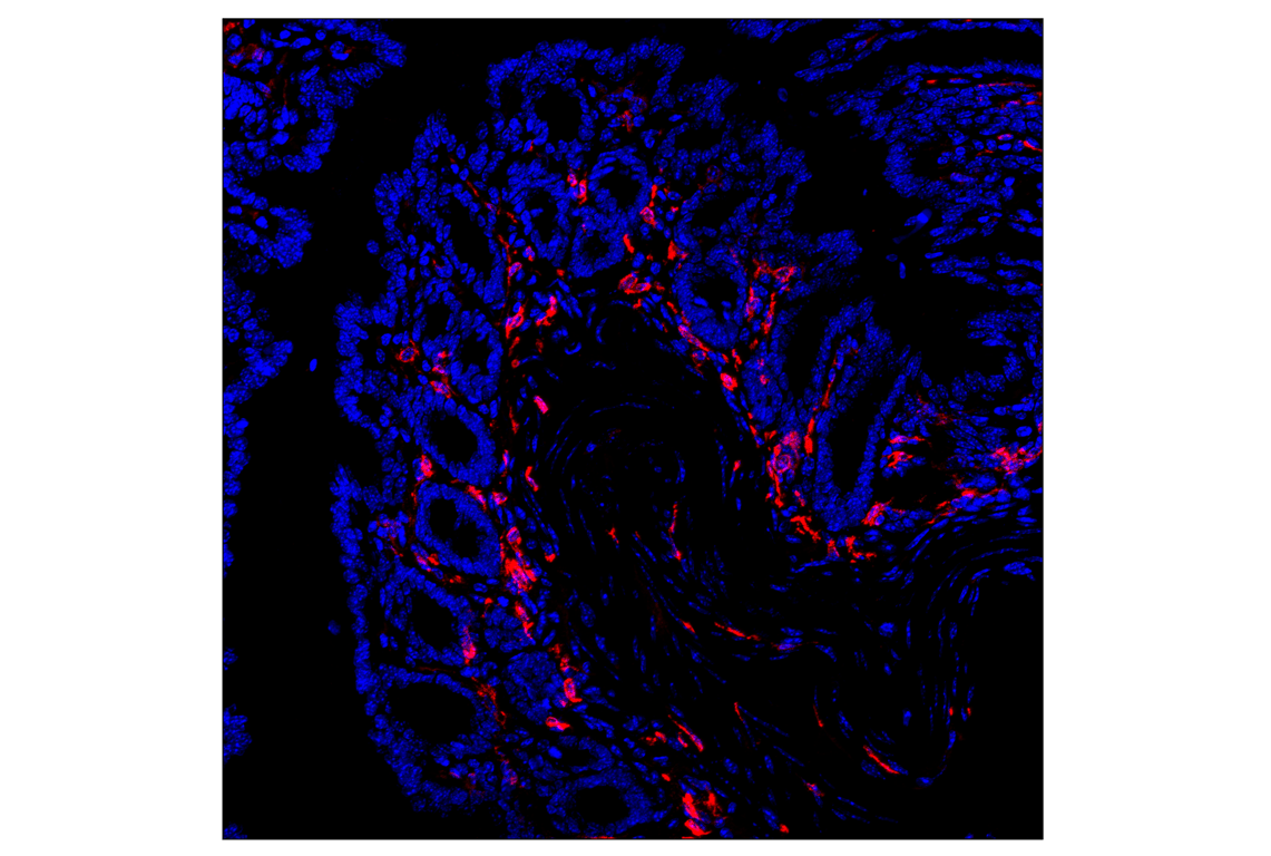 Immunofluorescence Image 2: CD206/MRC1 (E6T5J) Rabbit Monoclonal Antibody (Alexa Fluor<sup>®</sup> 555 Conjugate)