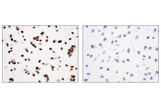 Immunohistochemistry Image 1: N-Myc (D4B2Y) Rabbit Monoclonal Antibody