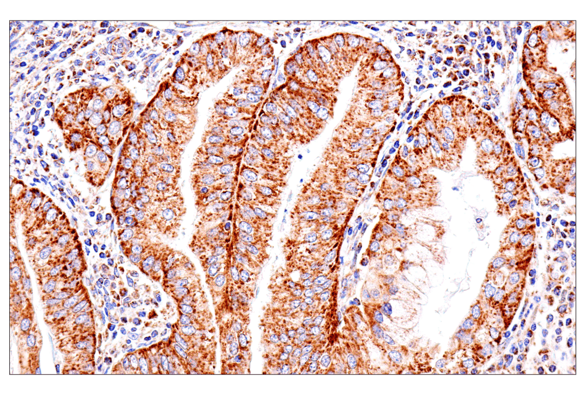 Immunohistochemistry Image 1: SLC25A1 (E7B2B) Rabbit Monoclonal Antibody