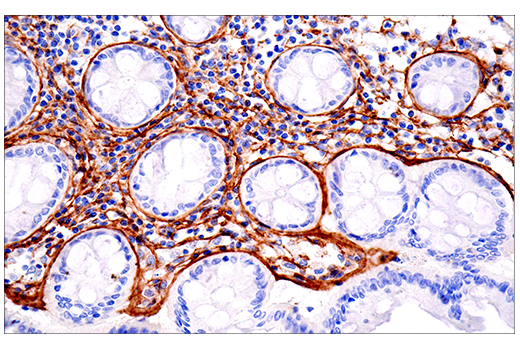 Immunohistochemistry Image 5: COL1A1 (E3E1X) Mouse Monoclonal Antibody (BSA and Azide Free)