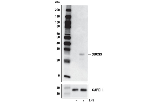 undefined Image 15: Jak/Stat Pathway Inhibitors Antibody Sampler Kit
