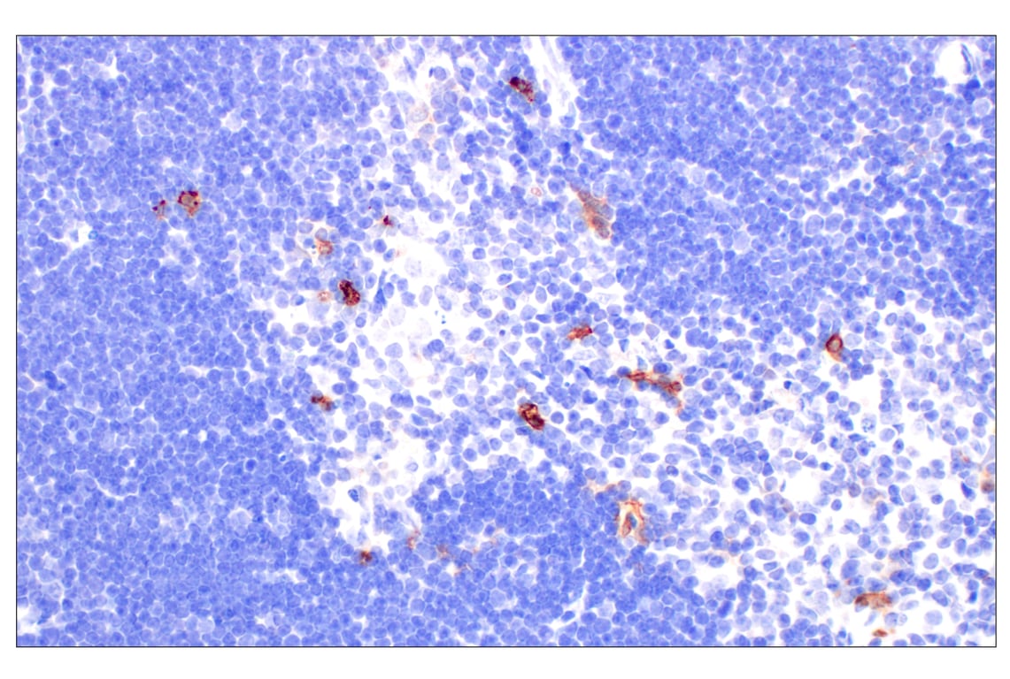 CD11b/ITGAM (E4K8C) Rabbit mAb | Cell Signaling Technology