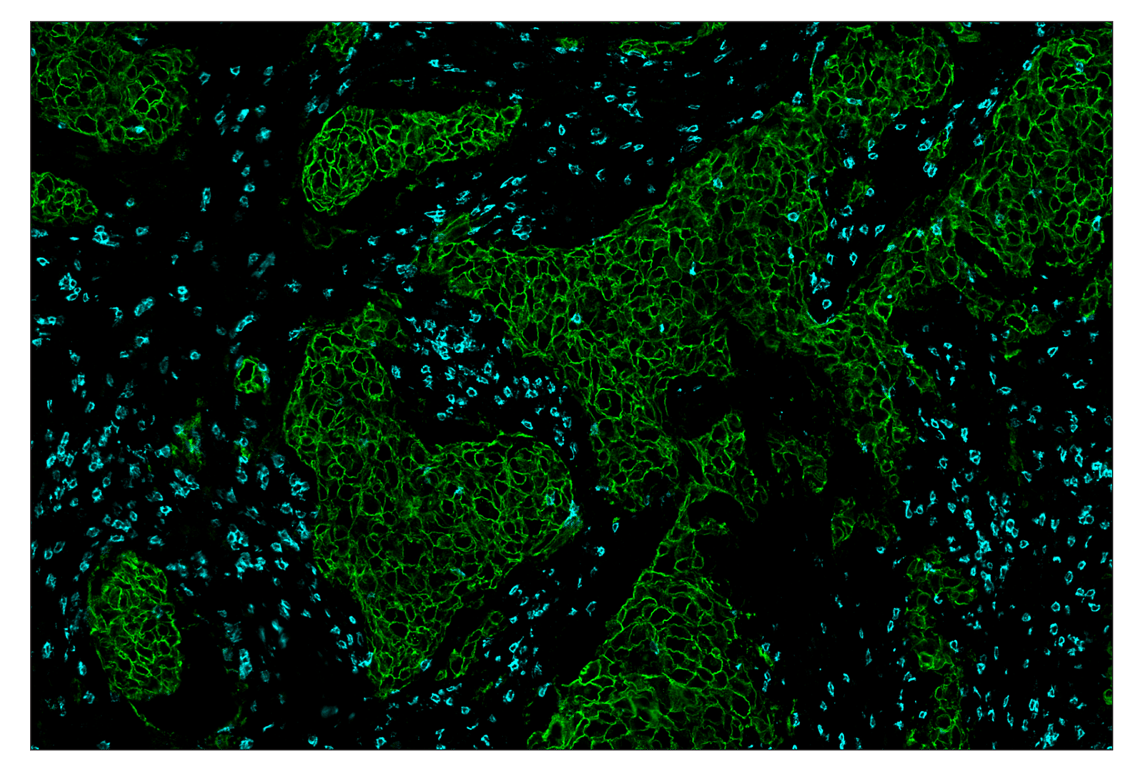 Immunohistochemistry Image 1: HER2/ErbB2 (D8F12) & CO-0059-647 SignalStar<sup>™</sup> Oligo-Antibody Pair