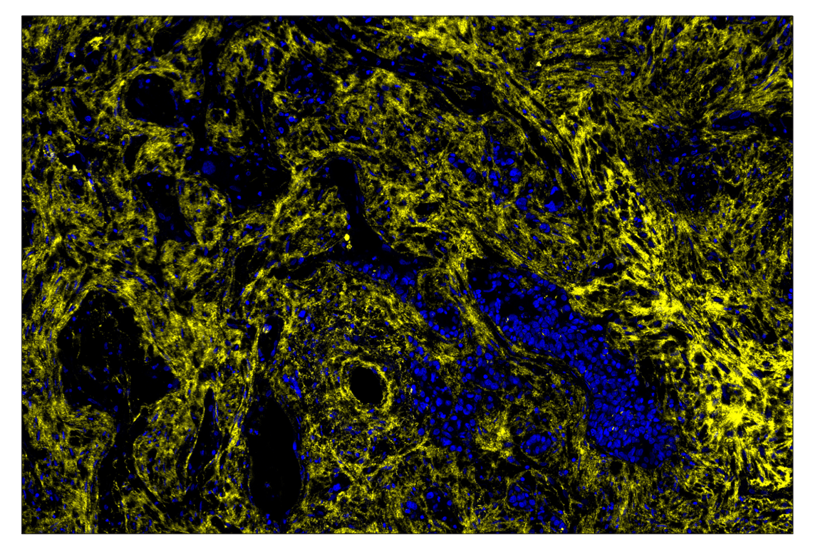 Immunohistochemistry Image 2: Fibronectin/FN1 (E5H6X) & CO-0203-594 SignalStar<sup>®</sup> Oligo-Antibody Pair