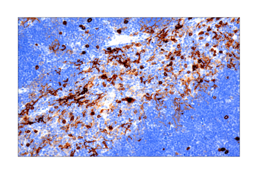 Immunohistochemistry Image 1: IL-2R alpha/CD25 (E9W2J) Rabbit Monoclonal Antibody