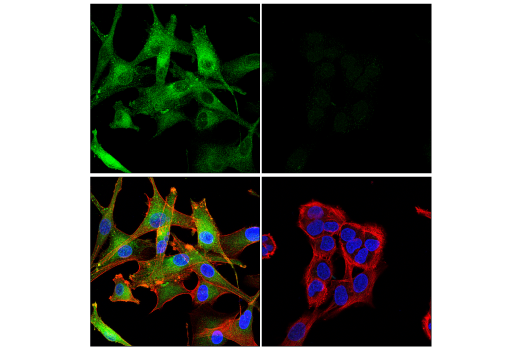 Immunofluorescence Image 1: Rab27B (E4V3O) Rabbit Monoclonal Antibody