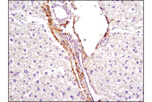 Immunohistochemistry Image 1: PKM1 (D30G6) Rabbit Monoclonal Antibody