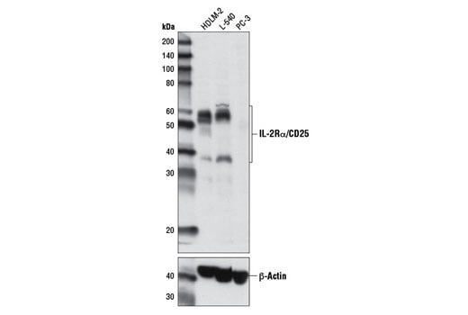 Western Blotting Image 1: IL-2Rα/CD25 (D6K5F) Rabbit mAb