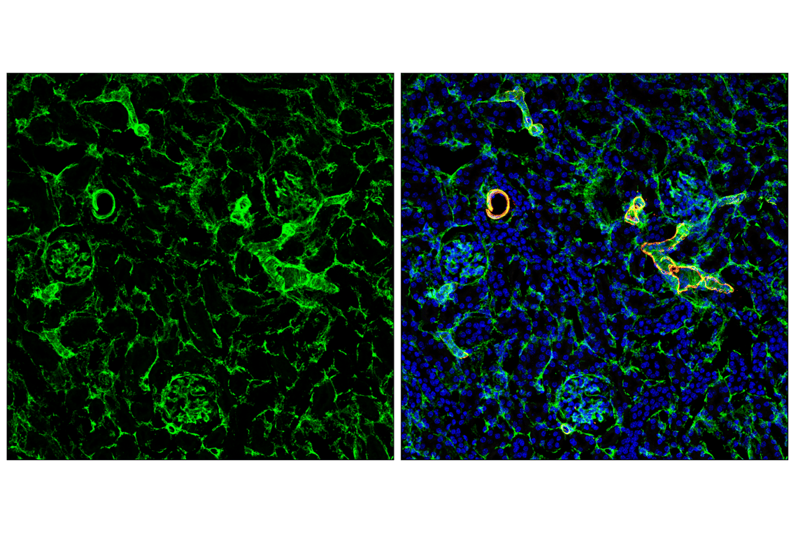 Immunofluorescence Image 2: Caldesmon-1 (D5C8D) Rabbit Monoclonal Antibody