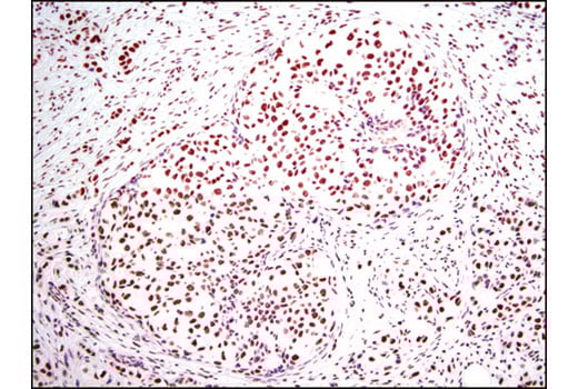 undefined Image 8: Acetyl-Histone Antibody Sampler Kit