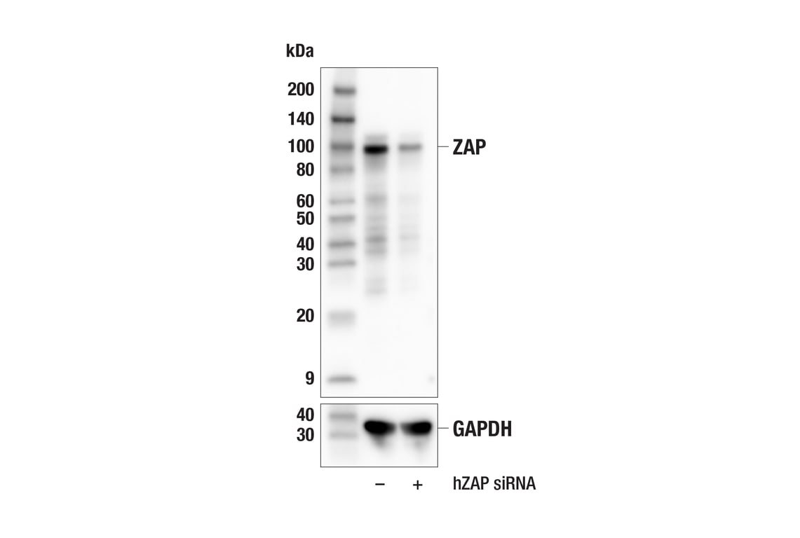 Western Blotting Image 2: ZAP (E7E8D) Rabbit Monoclonal Antibody