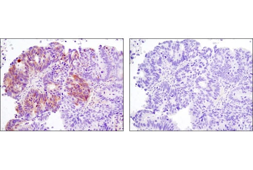 undefined Image 21: Hippo Signaling Antibody Sampler Kit