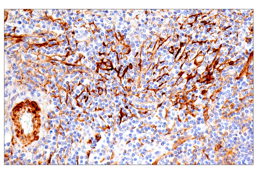 Immunohistochemistry Image 8: CRP2 (E8R5N) Rabbit Monoclonal Antibody